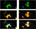 Immunofluoresence of COS-7 cells expressing TPH2-flag using Aves Labs chicken anti-TPH2 antibody (green) and rabbit anti-flag antibody (red). Blue is DAPI nuclear stain showing nuclei of both transfected and untransfected cells. Staining shows 100% correspondence between chicken anti-TPH2 signal and anti-flag in transfected cells.