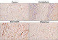 Section of formalin fixed, paraffin-embedded rat brain showing staining of TPH2. Sections were stained with Aves Labs anti-TPH2 antibody at 1:200 dilution and detected with anti-chicken HRP.