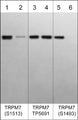 Western blot image of human autophosphorylated TRPM7 C-terminal kinase domain (lanes 1-6). The blot was treated with lambda phosphatase to dephosphorylate TRPM7 phosphosites (lanes 2, 4, & 6). The blot was probed with rabbit polyclonals anti-TRPM7 (Ser-1513), phospho-specific (lanes 1 & 2), anti-TRPM7 (a.a.1484-1497), TP5691 antibody (lanes 3 & 4), or anti-TRPM7 (Ser-1493), phospho-specific (lanes 5 & 6).