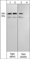 Western blot of rat PC12 cells stimulated with Calyculin A (100 nM) for 30 min (lanes 1-4). The blot was treated with lambda phosphatase (lanes 2 & 4), then probed with mouse monoclonal anti-Talin (8D4) (lanes 1 & 2) or rabbit polyclonal anti-Talin (Ser-425) (lanes 3 & 4) antibodies.