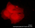 Immunocytochemical labeling of β-tubulin in aldehyde fixed and NP-40 permeabilized human NCI-H1299 lung carcinoma cells. The cells were labeled with rabbit polyclonal anti-unphosphorylated β-Tubulin (TP1811). The antibody was detected using goat anti-rabbit DyLight® 594.