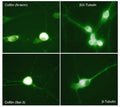 Immunocytochemical labeling in chick dorsal root ganglion neurons using anti-Cofilin (N-terminus; CP1131), anti-Cofilin (Ser-3; CP1151), anti-βIII-Tubulin (C-terminus; TP1691) and anti-β-Tubulin (TM1541) antibodies. (Images provided by Dr. Diane Snow, Department of Anatomy & Neurobiology, University of Kentucky).
