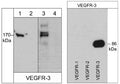 Left: Western blot image of human K-562 cells (lanes 1 & 2) and HUVEC (lanes 3 & 4). The blots were probed with rabbit polyclonal anti-VEGFR-3 (a.a. 1285-1298) in the absence (lanes 1 & 3) or presence of blocking peptide (VX2945) (lanes 2 & 4). Right: Western blot image of GST-recombinant human VEGFR-1 (89 kDa), VEGFR-2 (110 kDa), and VEGFR-3 (86 kDa) C-terminal regions. The blot was probed with anti-VEGFR-3 (a.a. 1285-1298).