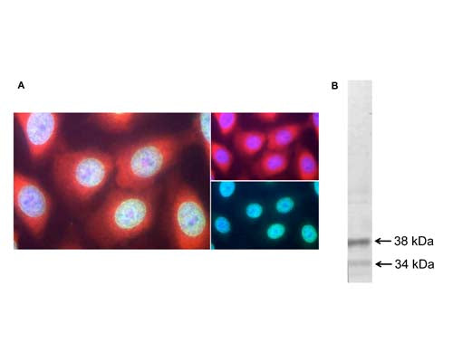 A: Immunofluorescence analysis of casein kinase 1 alpha expression (red) in HeLa cells with C-1371-100. Casein kinase 1 alpha immunoreactivity is observed in the nucleus and the cytoplasm. Nuclear pore complexes (green) were stained with monoclonal antibody M-1397-250. Cell nuclei were visualized with Hoechst dye (blue).B: Western blot of whole rat spinal cord homogenate. C-1371-100 (1:10,000 dilution) detects 2 bands at apparent molecular weights of ~38 kDa and ~34 kDa, corresponding to CK1 alpha and related isotypes.