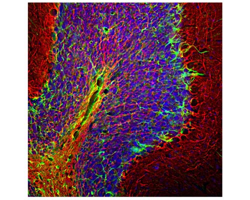 Image of a rat cerebellum section by Immunofluorescence and Immunohistochemistry. The section was stained with C-1386-50, Neurofilament heavy polypeptide, phosphorylated (pNF-H), Chicken pAb, (red, 1:5,000) and co-stained with product R-1374-50, Glial Fibrillary Acidic Protein (GFAP), Rabbit pAb (green). The blue is DAPI staining of nuclear DNA. Method: following transcardial perfusion with 4% paraformaldehyde, brain was post fixed for 24 hours, cut to 45 uM, and free floating sections were stained. The NF-H antibody labels network of axons of different neurons, while the GFAP antibody stains astrocytes.