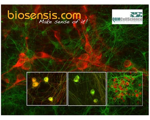 Background image: Substantia Nigra neurons from QBM CellScience thawed and cultured for 5 days and stained with Biosensis rabbit antibody to Tyrosine Hydroxylase (red, Catalog Number R-148-50) and monoclonal antibody Tuj (green). Photo courtesy of QBM Cell Science. Left and middle image: Dorsal Root Ganglia neurons from QBM CellScience thawed and cultured for 7 days and stained with Biosensis chicken antibody to Peripherin (red, Catalog Number C-1399-50) and monoclonal antibody Tuj (green). Photo courtesy of QBM Cell Science. Right image: Substantia Nigra neurons from QBM CellScience thawed and cultured for 14 days and stained with Biosensis rabbit antibody to NeuN (red, Catalog Number R-3770-100) and monoclonal antibody Tuj (green). Photo courtesy of QBM Cell Science.