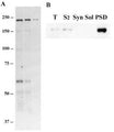 Western blotting with Chicken polyclonal antibody to mouse Dicer protein (C-1557-100) in mouse brain extracts. Figure A: Mouse brain cytosolic extract. Detection at 0.03 µg/mL. Protein loaded 20 µg, 10 µg and 5 µg. Figure B: Mouse brain subcellular fractionation. Detection at 0.03 µg/mL. Protein loaded 10 µg.