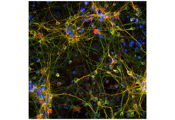 Immunofluorescence analysis of tau protein expression in cortical neuron-glial culture from E20 rat. The chicken anti-tau antibody (green, 1:2,000) stains perikarya, dendrites and axons of neurons, while a anti-MAP2 antibody labels only dendrites and perikarya (red). Perikarya and dendrites appear orange-yellow, since they contain both MAP2 and tau proteins. Blue: DAPI nuclear stain.