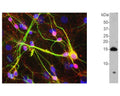 Left: Analysis of alpha-synuclein expression in mixed rat neuron-glial cultures by Immunocytochemistry. The alpha-synuclein antibody (red) stains vesicular structures the perikarya and processes of the neurons. The antibody reveals that some of the neuronal perikarya contain more alpha-synuclein than others. Green: MAP2, Blue: DNA. Right: Detection of alpha-synuclein monomer (~15 kDa) in crude rat brain extract by Western Blotting.
