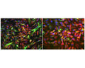 Nestin staining (red) in normal human atrial cardiac fibroblasts (3DIV) by Immunocytochemistry, using chicken antibody to nestin, C-1812-50. Green: beta-tubulin (left), anti-fibroblast antibody (right). Blue: cell nuclei. Image courtesy of QBM Cell Science.