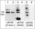 Western blot image of human Jurkat cells treated with calyculin A (100 nM) for 30 min. (lanes 1-6), then some lanes of the blot were treated with lambda phosphatase (lanes 2, 4 & 6). The blot was probed with rabbit polyclonals anti-eEF2K (C-terminus) (lanes 1 & 2), anti-eEF2K (Ser-445) phospho-specific (lanes 3 & 4), and anti-eEF2K (Ser-398) phospho-specific (lanes 5 & 6).