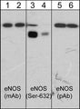 Western blot analysis of human umbilical vein endothelial cells before (lanes 1, 3, 5) and after (lanes 2, 4, 6) treatment with lambda phosphatase. The blots were probed with anti-endothelial Nitric Oxide Synthase (eNOS) monoclonal antibody (lanes 1 & 2), anti-eNOS (Ser-632) phospho-specific antibody (lanes 3 & 4), and anti-eNOS polyclonal antibody (lanes 5 & 6).