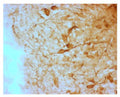 The 4% PFA fixed, frozen cryostat section of the sheep hypothalamus was incubated in guinea pig polyclonal antibodies to the mouse AGRP protein at the dilution of 1:1000 overnight followed by incubation with biotinylated secondary antibodies. Cell bodies and nerve terminals in the sheep brain are intensely stained. This figure shows staining of cells when no pre-absorption is performed.