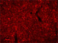 Immunohistochemical detection of AGRP in the arcuate nucleus of rat brain using Guinea pig polyclonal antibody to mouse agouti related protein (GP-029-50) incubated at the dilution of 1:1000-2000 in PBS overnight followed by incubation with Alexa-568 goat anti-guinea pig (1:500) secondary antibody. Section is 4% PFA fixed, frozen, cyrosectioned material. In rodents nerve terminals are more often identified than whole cell bodies using GP-029-50