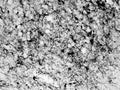 Immunohistochemical detection of agouti-related protein (AGRP) synthesizing neurons in the human infundibular nucleus using the GP-029-50 primary antibody (1:50 000), followed by its visualization with the biotinylated secondary antibody-ABC method and nickel-diaminobenzidine chromogen. Photo courtesy of Dr. Erik Hrabovszky, Hungarian Academy of Sciences, Budapest, Hungary.