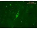 Figure shows staining of cells in sheep hypothalamus using Guinea pig polyclonal antibody to human alpha MSH (GP-030-50) at 1:1000 followed by incubation with FITC labeled goat anti-guinea pig secondary antibodies.