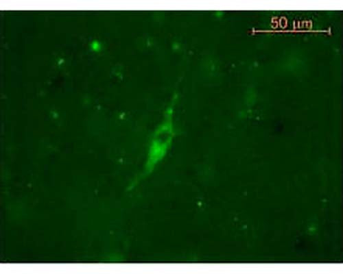 Figure shows staining of cells in sheep hypothalamus using Guinea pig polyclonal antibody to human alpha MSH (GP-030-50) at 1:1000 followed by incubation with FITC labeled goat anti-guinea pig secondary antibodies.