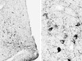 Immunohistochemical identification of alpha MSH-immunoreactive neurons in cryostat sections from the hypothalamic arcuate nucleus of the rat. The signal was detected with the gp-030-50 primary antiserum (1:40,000), followed by its visualization with the biotinylated secondary antibody-ABC method and nickel-diaminobenzidine chromogen. Photo courtesy of Dr. Erik Hrabovszky, Hungarian Academy of Sciences, Budapest, Hungary.