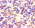 The cryostat section of the sheep pituitary was incubated in guinea pig polyclonal antibodies to ovine luteinizing hormone at the dilution of 1:1000 overnight followed by incubation with biotinylated secondary antibodies. Cell bodies and nerve terminals in the sheep brain are intensely stained (brown). This figure shows staining of cells when no pre-absorption is performed.