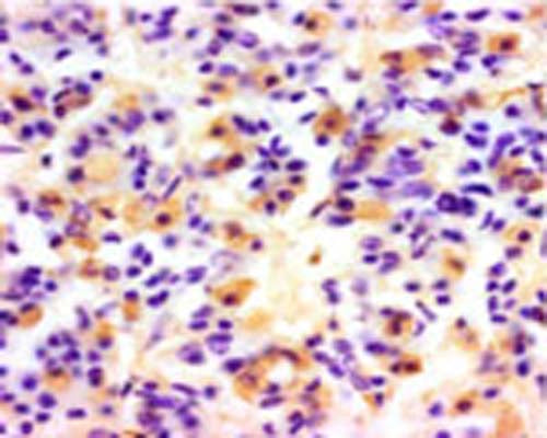 The cryostat section of the sheep pituitary was incubated in guinea pig polyclonal antibodies to ovine luteinizing hormone at the dilution of 1:1000 overnight followed by incubation with biotinylated secondary antibodies. Cell bodies and nerve terminals in the sheep brain are intensely stained (brown). This figure shows staining of cells when no pre-absorption is performed.