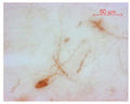 The cryostat section of the sheep hypothalamus was incubated in guinea pig polyclonal antibodies to oxytocin at the dilution of 1:1000 overnight followed by incubation with biotinylated secondary antibodies. Cell bodies and nerve terminals (from cells that produce this hormone) in the sheep brain are intensely stained. This figure shows staining of cells when no pre-absorption is performed.