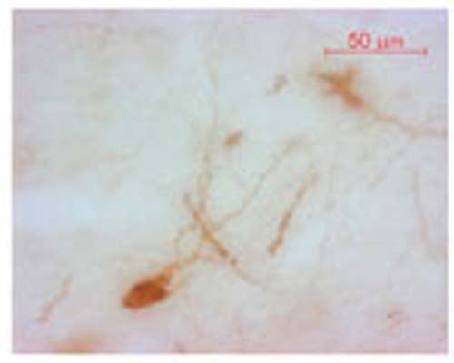 The cryostat section of the sheep hypothalamus was incubated in guinea pig polyclonal antibodies to oxytocin at the dilution of 1:1000 overnight followed by incubation with biotinylated secondary antibodies. Cell bodies and nerve terminals (from cells that produce this hormone) in the sheep brain are intensely stained. This figure shows staining of cells when no pre-absorption is performed.