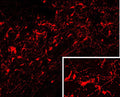 Immunofluorescent visualization of magnocellular oxytocin neurons in formalin-fixed floated cryostat section from the human paraventricular nucleus. The oxytocin antiserum (gp-037-50; 1:3,000) was reacted with Cy3-conjugated anti-guinea pig antibodies. Photo courtesy of Dr. Erik Hrabovszky, Hungarian Academy of Sciences, Budapest, Hungary.