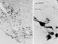 Immuno-peroxidase detection of oxytocin neurons in the human hypothalamic supraoptic nucleus, using guinea pig polyclonal oxytocin antibodies (gp-037-50; 1:50,000) with the biotinylated secondary antibody-ABC technique and Ni-DAB chromogen. Photo courtesy of Dr. Erik Hrabovszky, Hungarian Academy of Sciences, Budapest, Hungary.