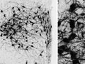 Immuno-peroxidase detection of oxytocin neurons in the hypothalamic paraventricular nucleus of the rat, using guinea pig polyclonal oxytocin antibodies (gp-037-50; 1:50,000) with the biotinylated secondary antibody-ABC technique and Ni-DAB chromogen. Photo courtesy of Dr. Erik Hrabovszky, Hungarian Academy of Sciences, Budapest, Hungary.