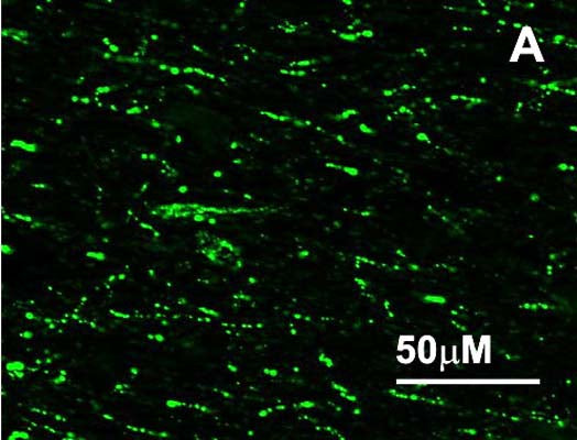 Immunoreactivity of cells and terminals in sheep hypothalamus section using anti-RFRP-3 antibody (1:2000).