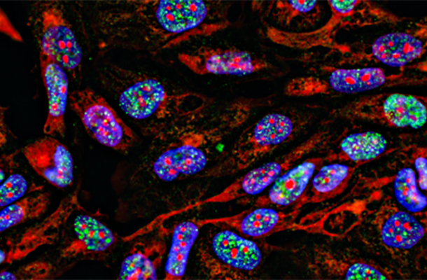 ImmunoFluoroMount™ with PPD