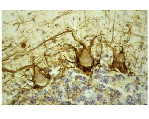 Image of a human cerebellar cortex section by Immunohistochemistry. The section was stained with M-1387-50, Neurofilament heavy polypeptide, phosphorylated (pNF-H), Clone NAP4, Mouse mAb (brown) and co-stained with heamatoxylin-eosin (blue). This antibody stains prominent basket cell axons surrounding the large Purkinje neurons. The granule cell layer is at the bottom of the image with the molecular layer at the top. IHC method: Section are fixed in formalin, embedded in paraffin using the ABC (avidin biotin conjugate).
