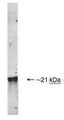 Whole HeLa cell lysate stained with mouse anti-DJ1 antibody. The antibody recognizes the ~21 kDa protein.