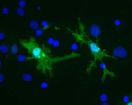 Image shows rat brain neural cultures stained with Mouse Monoclonal Antibody to Galectin-3 M-1574-100 (green) and DNA (blue). Staining can be seen in several types of glia and lymphocytic cells, including these cells which have the morphology of microglia. Surrounding cells reveal no Galectin-3 staining.