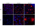 Immunofluorescent detection of Aβ in coronal sections 4-month, 8-month and 24-month old 3xTg mice stained with M-1586-100. Staining shows intraneuronal Aβ increased from 4- to 8-months and decreased by 24-months while extracellular Aβ increased from 8- to 24months (top=20x, scale bar 50um; bottom = 63x, scale bar 20um). Figure courtesy of Youmans et al (2012).
