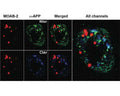 Immunohistochemical detection of Aβ and APP in coronal sections of the frontal cortex of 1-month old 5xFAD mice. Sections were co-stained with M-1586-100 or APP antibodies (N-terminus and C-terminus). MOAB-2 staining was punctate and did not co-localize with either APP antibodies. Figure courtesy of Youmans et al (2012).