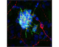 Rat brain neural cultures stained with mouse anti-DCX (green), chicken polyclonal antibody to MAP2 (Catalog Number C-1382-50) (red) and DNA (blue). The mouse anti-DCX antibody (Catalog Number M-1648-100) reveals strong cytoplasmic staining in a population of small developing neurons. These cells are often found in small clumps as in these cultures, as in this example. Note that they are not positive for MAP2, which is characteristic of more mature neurons, and that the mature neuron shown is negative for DCX. This DCX antibody is therefore an excellent marker of developing neuronal cells.