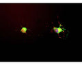 E18 hippocampal neurons were grown for seven days. The neurons were fixed and immunostained with M-1703-100 (red channel). The cells were also stained in green with C-1377-50, our chicken antibody to alpha Internexin and DNA (blue). M-1703-100 stains the neuronal perikarya and process strongly, and does not stain non neuronal cells in these cultures. The alpha internexin antibody stains intermediate or 10nm filament bundles in the cytoplasm of these cells.