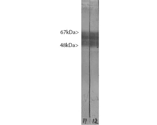 Crude rat brain extract. Tau protein is expressed as up to 9 different isoforms of different molecular weight and so appears as multiple closely spaced bands covering the region of the blot from 48 kDa to 67 kDa.