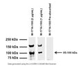 Western blot of TrpV1 in mouse brain homogenate (25 µg/lane). M-1714-100 detects bands at 90-100 kDa and 180-200 kDa corresponding to capsaicin receptor monomer and dimer. SDS-PAGE: denatured and reduced; Transfer: Tris-Glycine buffer; Membrane: nitrocellulose (0.45 µm); Blocking: 5% skim milk in TBST, 1 hour at RT; Primary antibody: overnight at 4°C; Secondary antibody: anti-mouse-HRP (1/6000) 2 hours at RT; Detection: Chemiluminiscence.