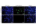 Immunofluorescence analysis of proNGF expression in human DU145 prostate cancer cells. Fixed (4% formaldehyde), permeabilized, and blocked (10% normal horse serum, 0.1% Triton X100) DU145 cells were incubated with proNGF antibody M-1738-100 (2 µg/mL, green) for 1 hour. Primary antibody binding was visualized with a secondary donkey anti-mouse-CF488A antibody (4 µg/mL, 1 hour incubation). Cell nuclei were stained with Hoechst dye (blue). Magnification: 100x.