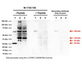 Western blot analysis of proNGF expression in DU145 and PC3 prostate cancer cell lysates. Monoclonal proNGF antibody M-1738-100 detects monomeric, non-glycosylated proNGF protein (20 ng, E.coli derived) at 25 kDa (Sample 1). PC3 (Sample 2, 100 µg) and DU145 (Sample 3, 100 µg) cell lysates show several proNGF isoforms (32 kDa, ~40 kDa, ~60 kDa, and higher molecular weight bands) as previously described, which most likely relates to glycosylated forms of full-length proNGF (Reinshagen et al., 2000; Lobos et al., 2005; Pedraza et al., 2005; Pundavela et al., 2014). Specificity of these bands is shown by pre-incubation with the immunizing peptide (5x mass of primary antibody), and a secondary antibody only control blot. Western Blotting Method: SDS-PAGE: denaturing and reducing, 4-20% Bis-Tris gel; Semi-Dry Transfer: Tris-Glycine (Towbin's) buffer with 20% methanol; Membrane: Nitrocellulose (0.45 µm); Blocking: 5% skim milk in TBST, 1 hour at RT; Primary antibody: 2 µg/mL, overnight at 4°C; Secondary antibody: anti-mouse-HRP (1/6000), 1 hour at RT; Detection: Chemiluminiscence.