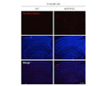Immunohistochemical detection of amyloid plaques in the brain of 9 months old WT and APP/PS1 mice. Brain tissues were fixed with 4% paraformaldehyde and dehydrated in 30% sucrose solution. 30 µm frozen sections were prepared and blocked in 5% Normal horse serum at room temperature for 1h. Then, sections were incubated with biotinylated MOAB-2 antibody (1:1000, red), overnight at 4°C. MOAB-2 binding was visualized with a streptavidin-Cy3 conjugate (1:1000, 1h). Cell nuclei were counterstained with DAPI dye. Figure courtesy of Dr C.S. Ruan, University of South Australia.