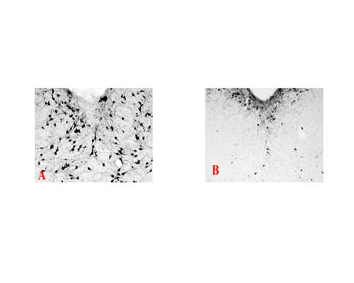 Immunohistochemical staining of p75NTR in rat forebrain. (A) Brain section from a control rat. (B) Brain section from a rat injected intraventricularly with 4 µg of 192-Saporin. Seven days after the treatment the rat was perfused with 4% paraformaldehyde and free floating section at 40 µm was used for staining.