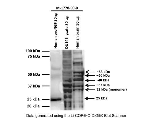 Western blot analysis of proNGF expression in human DU145 prostate cancer cell lysate and normal human brain. Biotinylated, monoclonal proNGF antibody M-1778-50-B (0.5 µg/mL) detects monomeric, non-glycosylated proNGF protein (E.coli derived) at 25 kDa (Lane 1). In DU145 cell lysate (Lane 2) and human brain (Lane 3), M-1778-50-B detects monomeric, glycosylated proNGF at 32 kDa, and several proNGF isoforms (~37 to ~53 kDa). These additional bands have not been characterized, but literature suggests that these bands are at least partly related to glycosylated forms of full-length proNGF (Reinshagen et al., 2000; Lobos et al., 2005; Pedraza et al., 2005; Pundavela et al., 2014). Western Blotting Method: SDS-PAGE: denaturing and reducing, 4-20% Bis-Tris gel; Semi-Dry Transfer: Tris-Glycine (Towbin) buffer with 20% methanol; Membrane: Nitrocellulose (0.45 µm); Blocking: 3% BSA in TBST, 1 hour at RT; Primary antibody: overnight at 4°C; HRP conjugate: streptavidin-HRP (25 ng/mL), 1 hour at RT; Detection: Chemiluminiscence.