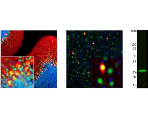 Left and middle: Detection of calbindin immunoreactivity in rat brain cerebellum (Left) and cortex (Middle) sections by Immunohistochemistry. Calbindin (red) is predominantly expressed in the dendrites and perikarya of Purkinje cells in the molecular layer of cerebellum (left), and selectively expressed in certain type of interneurons (calbindin-postive interneuron) in the cortex (middle). Methyl-CpG binding protein 2 (Rabbit anti-MeCP2, R-1810-100, green) is universally expressed in the nuclei of almost all neurons. As a result, double-immunofluorescence shows that calbindin-expressing cell somas appear red, but the nucleus appears to be yellow. Blue: DAPI nuclear stain. Insets represent high magnification images of the boxed areas. IHC method: 45 um sections, fixed by transcardial perfusion with 4% paraformaldehyde. Right: Western blot analysis of calbindin expression in cow cerebellum homogenate. The antibody shows strong immunoractivity with one calbindin band at ~30 kDa.