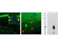 Left and Middle: Detection of calretinin immunoreactivity (red) in adult mouse brain hippocampal sections (Left) and adult rat cortical sections (Middle) by Immunohistochemistry. The calretinin antibody (1:1,000) stains a small number of interneurons in the stratum radiatum of CA1 region (Left), while Fox/NeuN (R-3770-100, green) is expressed in most neurons in the brain. As a result, co-labelled neurons that stain positive for calretinin appear yellow. In rat cortex (Right), calretinin (red) is expressed in a small population of interneurons concentrated in Layer 4 area, while calbindin (C-1798-50, green) is expressed in cells concentrated in Layer 2/3. Because each antibody specifically labels a different population of cells exclusively, the cells are either stained green or red in the cortex. Blue: DAPI nuclear stain. Insets are high-magnification images of the boxed area in each picture. IHC method: 45 um sections, tissue fixed by transcardial perfusion with 4% paraformaldehyde. Right: Western blot analysis of calretinin. The antibody binds strongly and cleanly to a calretinin band at ~32 kDa in cow cerebellum homogenate (Lane 1). Specificity for calretinin and absecnce of cross-reactivity with other related calcium-binding proteins is shown by probing recombinant proteins: secretagogin (Lane 2), parvalbumin (Lane 3), calretinin (Lane 4), calbindin (Lane 5).