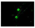 p75NTR staining (green) in rat trigeminal ganglion cells by Immunocytochemistry. Primary antibody dilution: 1:100. Image courtesy of QBM Cell Science.