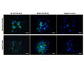Analysis of membrane p75NTR expression in rat C6 cells by Immunocytochemistry. Non-permeabilized cells were stained with mouse antibodies to p75NTR clones 8J2 (M-1818-100) and MLR2 (M-009-100) either on ice without fixation (top panel), or after fixation with 4% formaldehyde (bottom panel). Both antibodies reveal punctuate membrane staining of p75NTR receptor. This staining is specific, because negative mouse control antibody clone X63 (M-1249-100) does not show immunoreactivity. Method: Primary antibodies: 2 µg/mL, 1 hour incubation; Blocking: 10% normal horse serum, 30 minutes; Fixation: 4% formaldehyde, 10 minutes, either before application of primary antibody (bottom panel) or after application of primary antibody (upper panel); Secondary antibody: donkey anti-mouse-CF488A (2 µg/mL), 1 hour incubation. Cell nuclei were stained with Hoechst dye (blue), 1:1,000, 20 minutes at room temperature. Magnification: 100x.