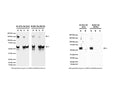 Left: Analysis of p75NTR expression in human and rodent RIPA cell lysates by Western Blotting. Mouse antibody to p75NTR clone 8J2 (M-1818-100) and clone MLR2 (M-009-100) detect p75NTR-IR at ~50-60 kDa in mouse p75NTR-transfected cells (A), but not in non-transfected control cells (B). p75NTR-IR is also observed in human SH-SY5Y (C) and rat C6 (D) cell lysates. Dependent on cell lysate, dimers or trimers (~150 kDa) of p75NTR are detected (Anastasia et al., 2015). 50 ug of protein were loaded per lane. WB Method: SDS-PAGE: 4-12%, non-reducing conditions; Transfer: Tris-Glycine buffer; Membrane: nitrocellulose (0.45 um); Blocking: 5% skim milk in TBST, 1 hour at RT; Primary antibody: 1 µg/mL, overnight at 4°C; Secondary antibody: anti-mouse-HRP (1/6000) 1 hour at RT; Detection: Chemiluminiscence. Right: Immunoprecipitation of p75NTR from rat C6 cell lysate and detection by Western Blotting. Mouse antibody to p75NTR clone 8J2 (M-1818-100) and clone MLR2 (M-009-100) precipitate bands at the expected molecular weight of ~50-60 kDa for p75NTR (A). No p75NTR-IR is observed in remaining supernatant (B) or control (Protein G only, C). IP Method: C6 lysates were prepared in non-denaturing lysis buffer and pre-cleared with Protein G agarose beads (40 uL bead slurry per 1 mg total protein). Cleared lysate was then incubated with either M-1818-100 or M-009-100 (10 ug antibody per 200 ug total protein), and immune complexes bound by Protein G agarose (10 uL). Precipitated p75NTR was eluted off the beads and antibody by heating and addition of SDS-PAGE sample buffer. WB Method: as above, with primary goat anti-p75NTR (1 µg/mL) antibody and secondary anti-sheep-HRP (1/6000) antibody. Detection: Chemiluminiscence.